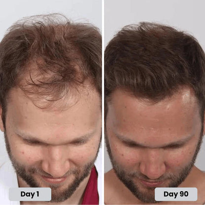 Red Light Therapy Cap for Hair Regrowth Treatments